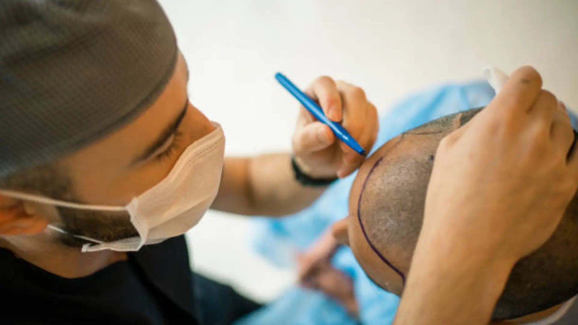 Advanced Hair Transplant Solutions in India